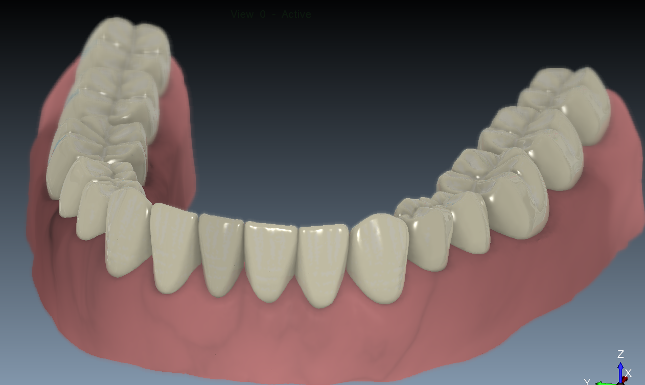 Ray traced teeth render